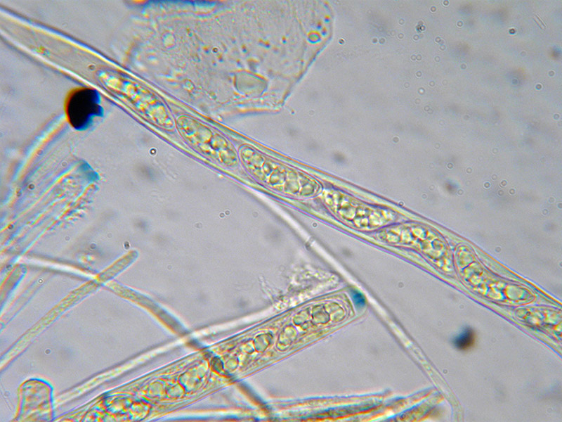 Phaeohelotium (extumescens?)